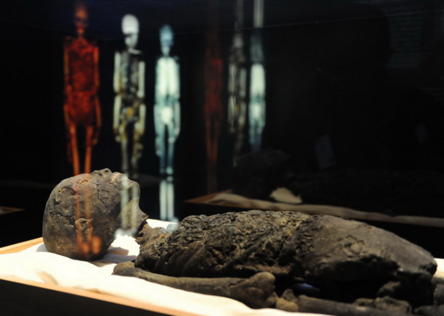 Смерть Тутанхамона — это убийство или несчастный случай?