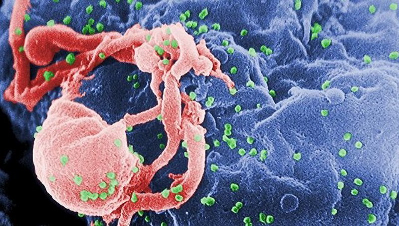 Ученые намерены уничтожить ВИЧ путем отключения в иммунных клетках определенных генов