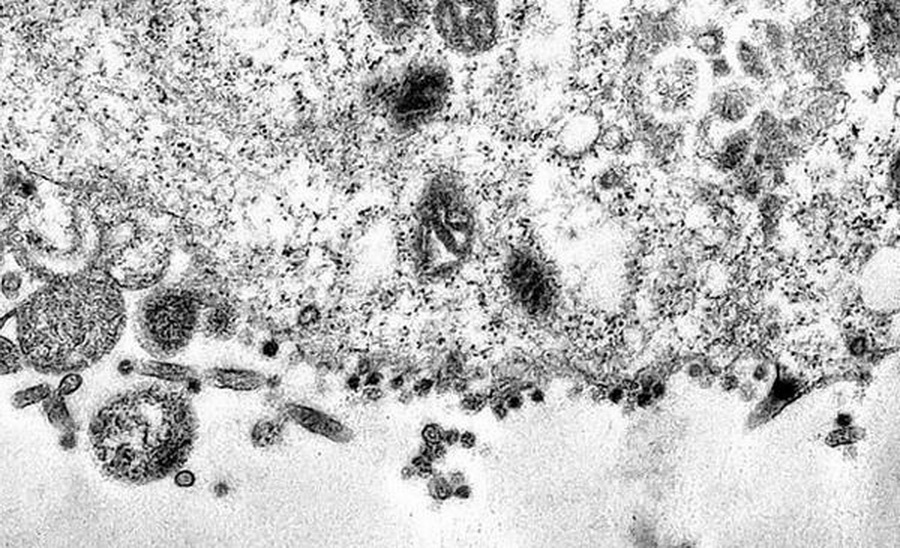 Момент заражения коронавирусом показали под микроскопом