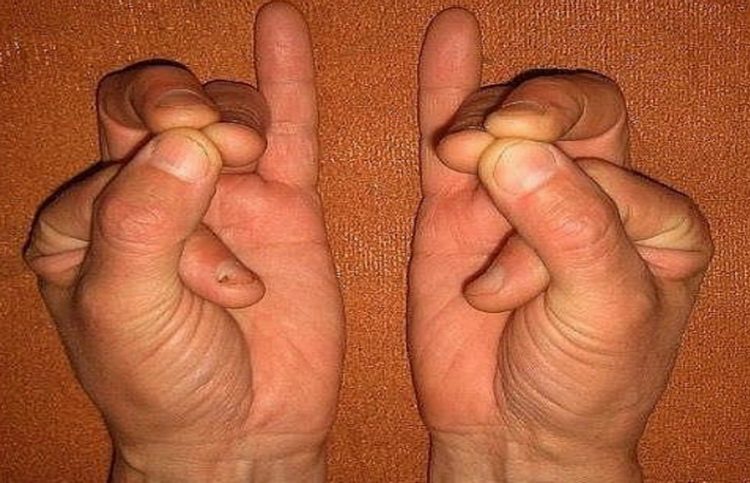 Эта комбинация пальцев может спасти вам жизнь